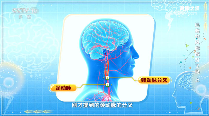 警惕脑卒中早期信号，这些“小毛病”也可能是身体发出的警报